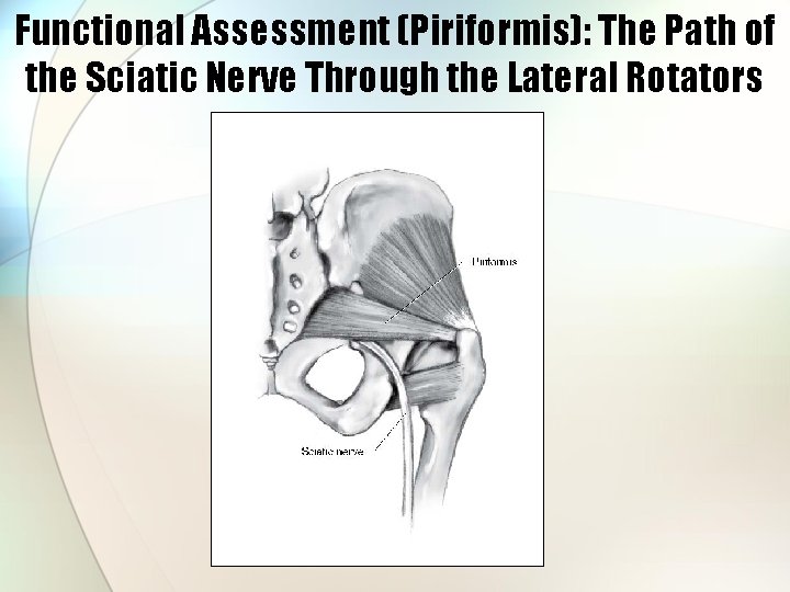 Functional Assessment (Piriformis): The Path of the Sciatic Nerve Through the Lateral Rotators 