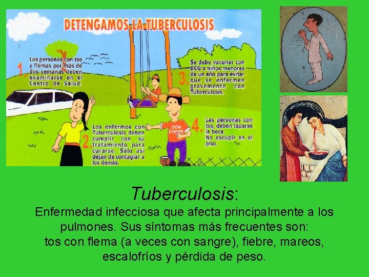 Tuberculosis: Enfermedad infecciosa que afecta principalmente a los pulmones. Sus síntomas más frecuentes son: Tuberculosis: Enfermedad infecciosa que afecta principalmente a los pulmones. Sus síntomas más frecuentes son: