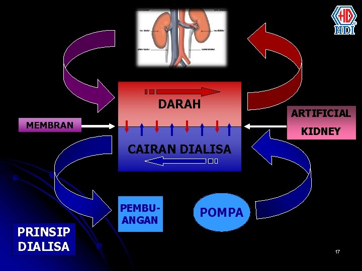 DARAH MEMBRAN ARTIFICIAL KIDNEY CAIRAN DIALISA PRINSIP DIALISA PEMBUANGAN POMPA 17 