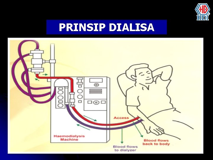 PRINSIP DIALISA 18 