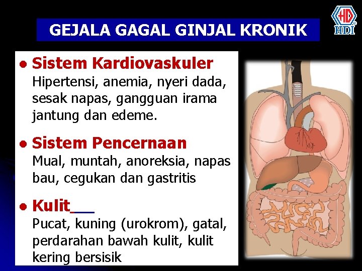 GEJALA GAGAL GINJAL KRONIK l Sistem Kardiovaskuler Hipertensi, anemia, nyeri dada, sesak napas, gangguan