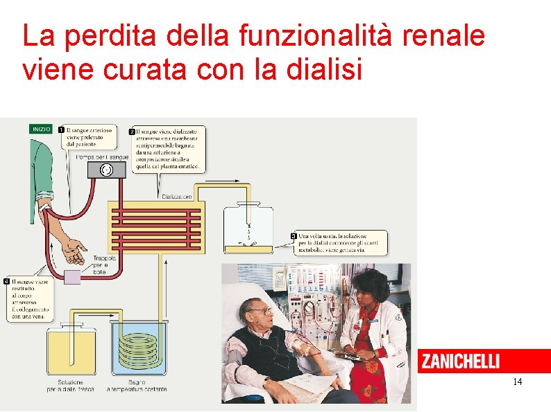 La perdita della funzionalità renale viene curata con la dialisi 14 Sadava et al.