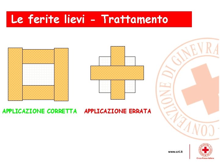 Le ferite lievi - Trattamento APPLICAZIONE CORRETTA APPLICAZIONE ERRATA 