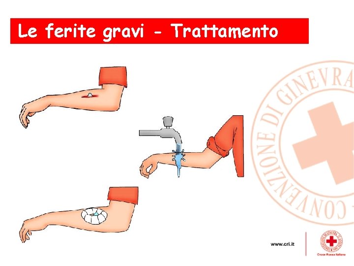 Le ferite gravi - Trattamento 