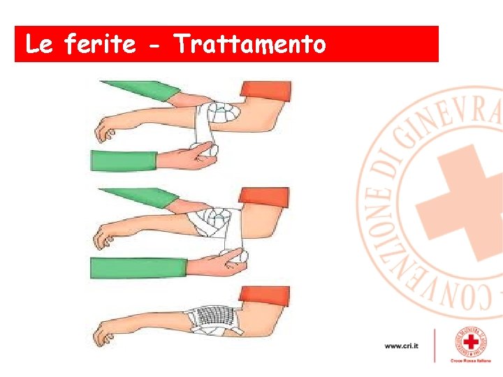 Le ferite - Trattamento 