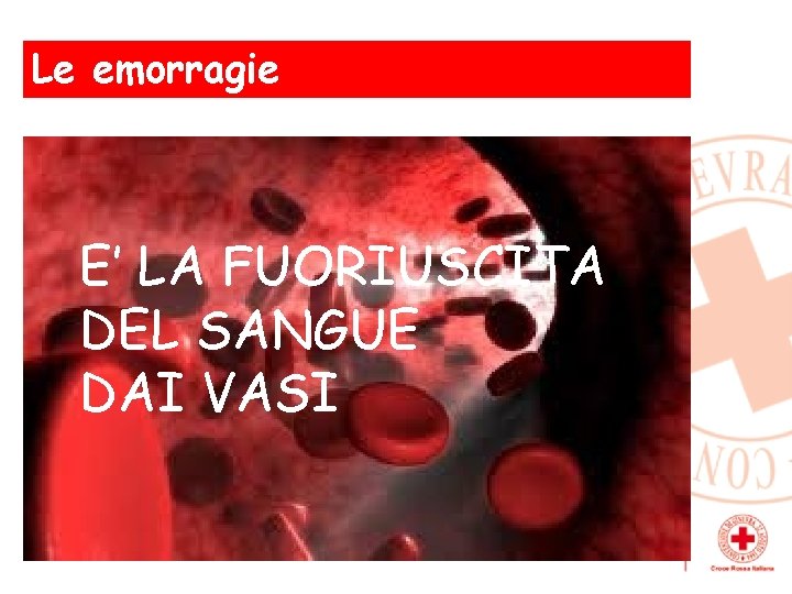 Le emorragie E’ LA FUORIUSCITA DEL SANGUE DAI VASI 