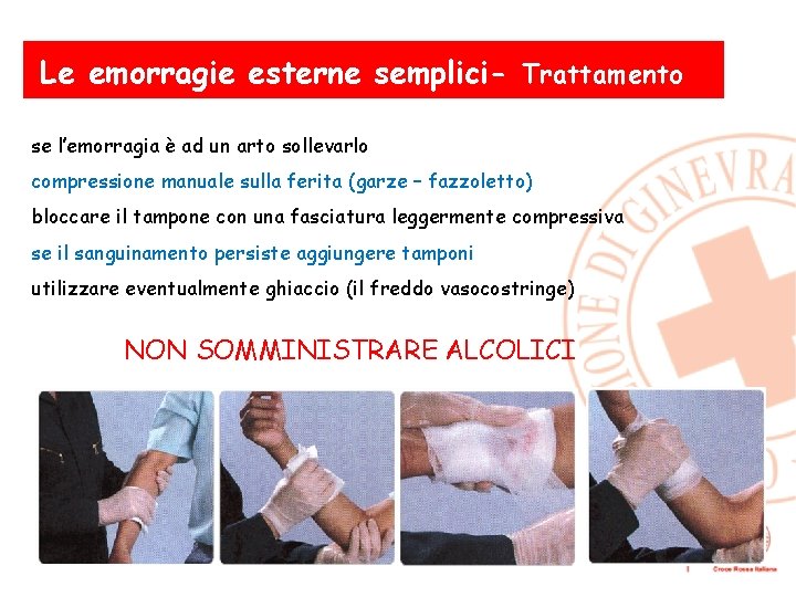 Le emorragie esterne semplici- Trattamento se l’emorragia è ad un arto sollevarlo compressione manuale