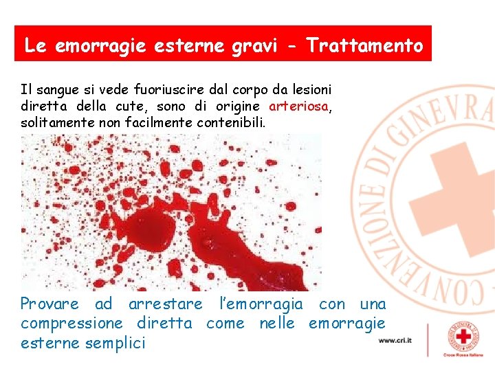 Le emorragie esterne gravi - Trattamento Il sangue si vede fuoriuscire dal corpo da