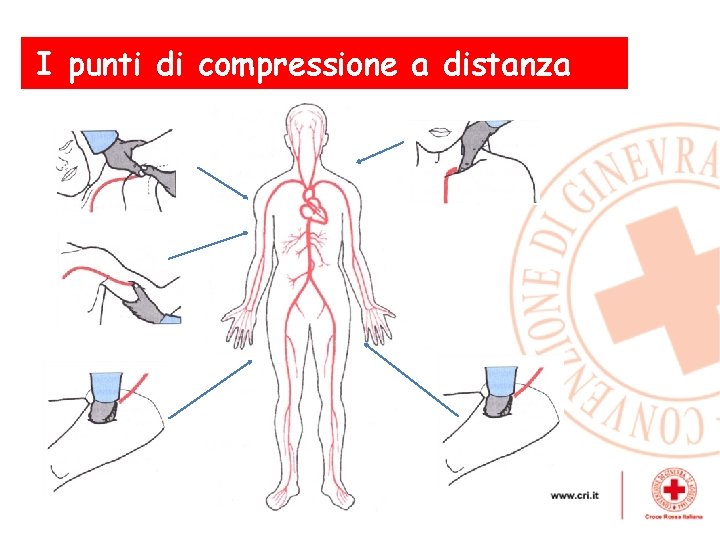 I punti di compressione a distanza Le emorragie esterne gravi - Trattamento 