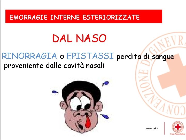EMORRAGIE INTERNE ESTERIORIZZATE DAL NASO RINORRAGIA o EPISTASSI perdita di sangue proveniente dalle cavità