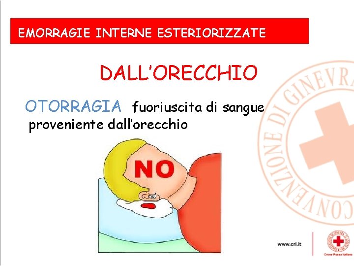 EMORRAGIE INTERNE ESTERIORIZZATE DALL’ORECCHIO OTORRAGIA fuoriuscita di sangue proveniente Le dall’orecchio emorragie esterne gravi