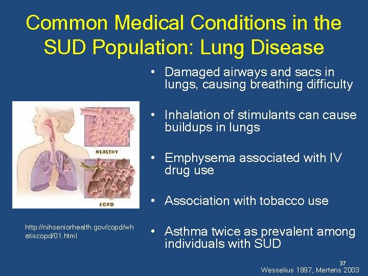 Common Medical Conditions in the SUD Population: Lung Disease • Damaged airways and sacs