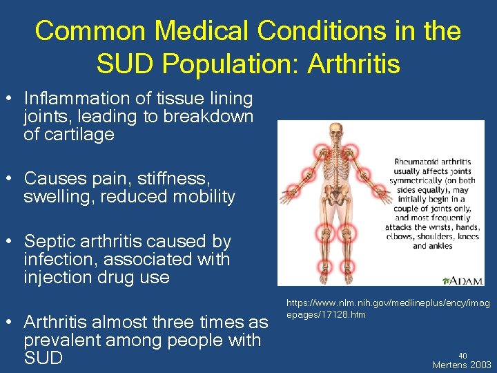 Common Medical Conditions in the SUD Population: Arthritis • Inflammation of tissue lining joints,