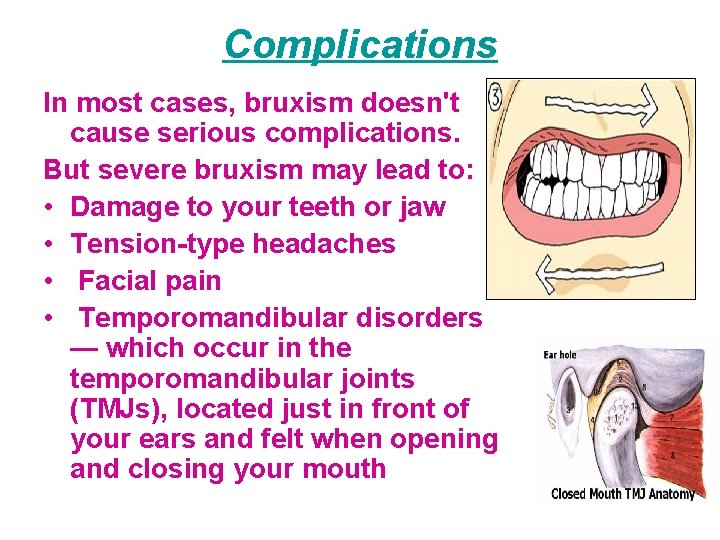 Complications In most cases, bruxism doesn't cause serious complications. But severe bruxism may lead