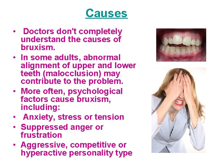 Causes • Doctors don't completely understand the causes of bruxism. • In some adults,