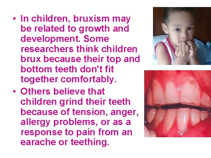  • In children, bruxism may be related to growth and development. Some researchers