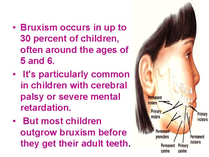  • Bruxism occurs in up to 30 percent of children, often around the
