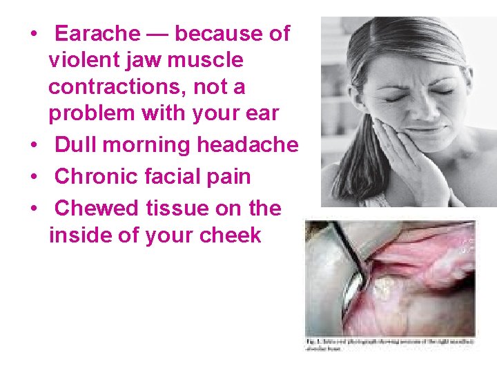  • Earache — because of violent jaw muscle contractions, not a problem with