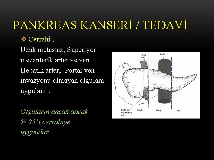 PANKREAS KANSERİ / TEDAVİ v Cerrahi ; Uzak metastaz, Superiyor mezanterik arter ve ven,