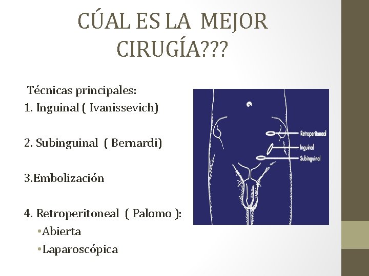 CÚAL ES LA MEJOR CIRUGÍA? ? ? Técnicas principales: 1. Inguinal ( Ivanissevich) 2.