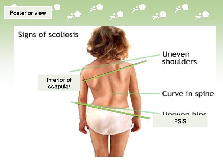 Posterior view Inferior of scapular PSIS 