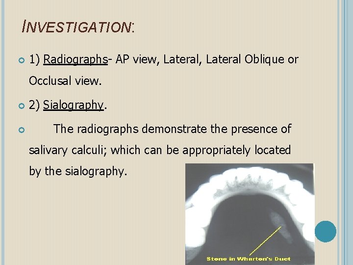 INVESTIGATION: 1) Radiographs- AP view, Lateral Oblique or Occlusal view. 2) Sialography. The radiographs
