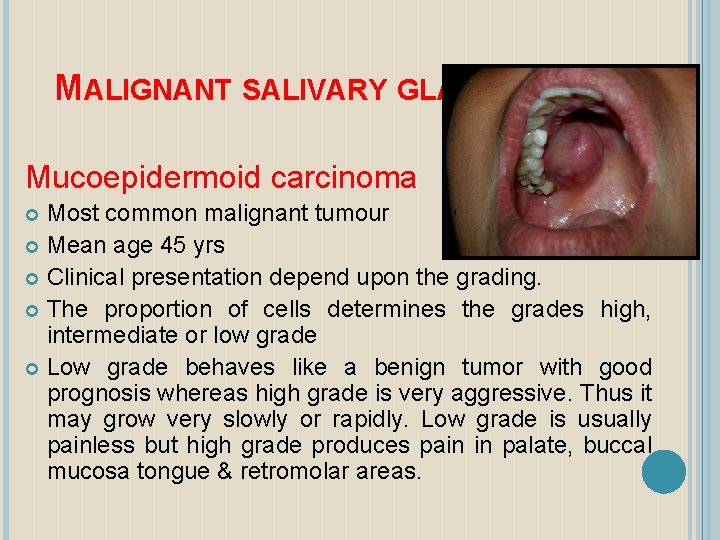 MALIGNANT SALIVARY GLAND TUMOURS Mucoepidermoid carcinoma Most common malignant tumour Mean age 45 yrs