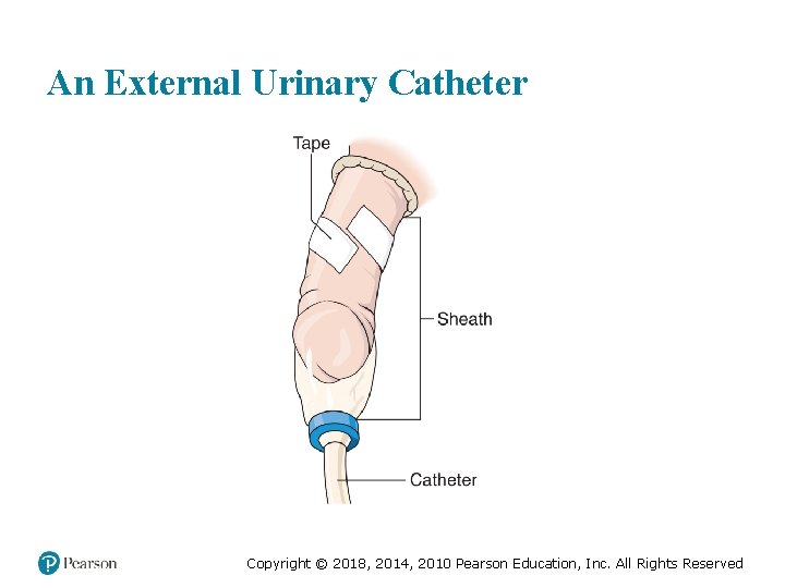 An External Urinary Catheter Copyright © 2018, 2014, 2010 Pearson Education, Inc. All Rights