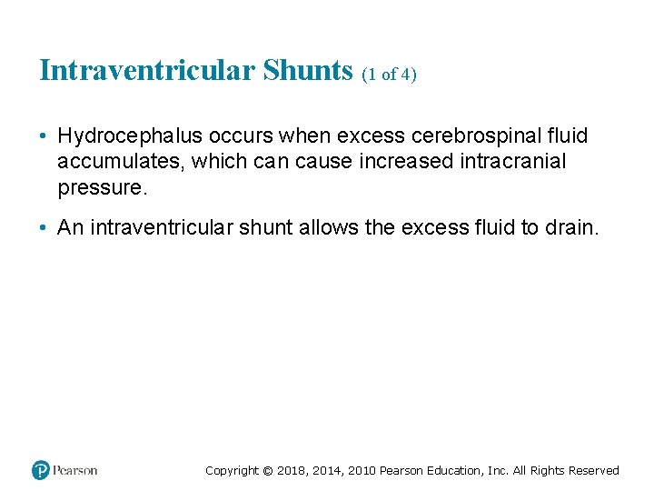 Intraventricular Shunts (1 of 4) • Hydrocephalus occurs when excess cerebrospinal fluid accumulates, which