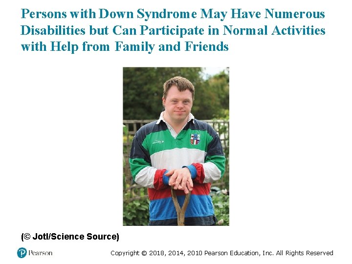 Persons with Down Syndrome May Have Numerous Disabilities but Can Participate in Normal Activities