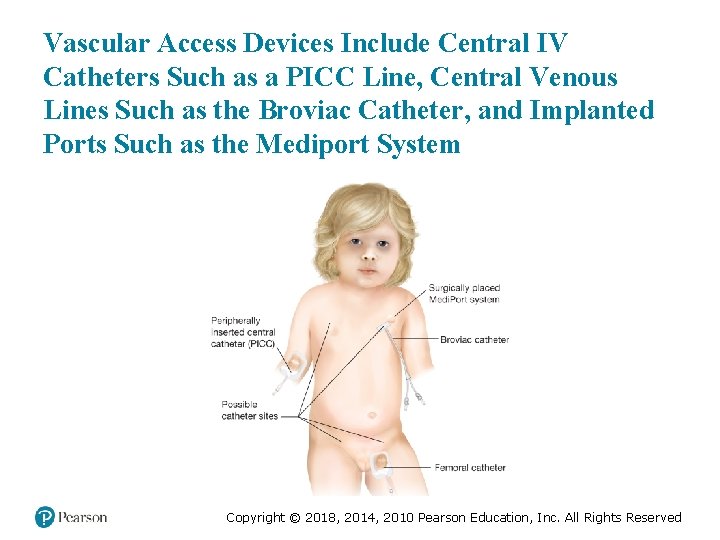 Vascular Access Devices Include Central IV Catheters Such as a PICC Line, Central Venous