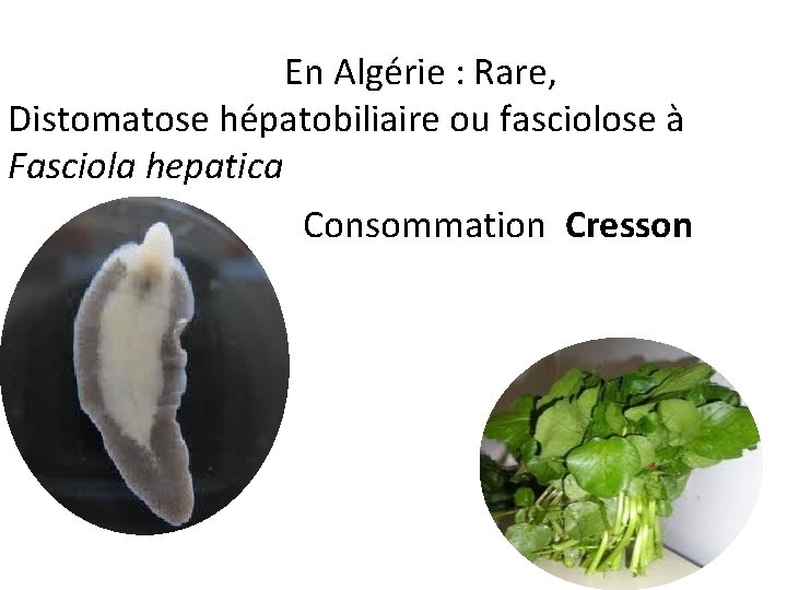  En Algérie : Rare, Distomatose hépatobiliaire ou fasciolose à Fasciola hepatica Consommation Cresson