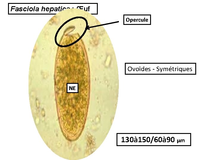Fasciola hepatica : Œuf Opercule Ovoïdes - Symétriques NE 130à 150/60à 90 µm 