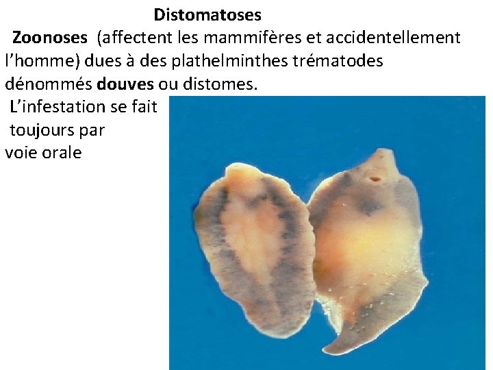  Distomatoses Zoonoses (affectent les mammifères et accidentellement l’homme) dues à des plathelminthes trématodes