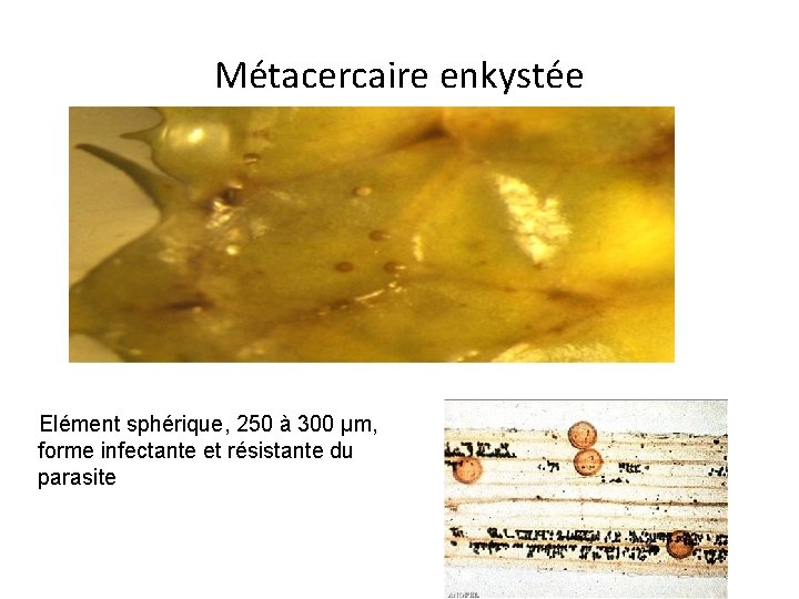 Métacercaire enkystée Elément sphérique, 250 à 300 μm, forme infectante et résistante du parasite