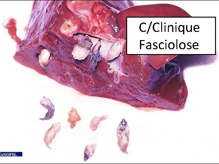  C/Clinique Fasciolose 