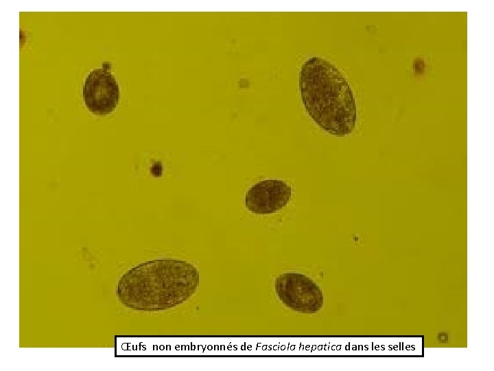 Œufs non embryonnés de Fasciola hepatica dans les selles 