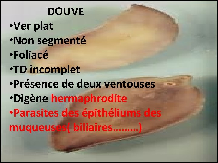 DOUVE • Ver plat • Non segmenté • Foliacé • TD incomplet • Présence