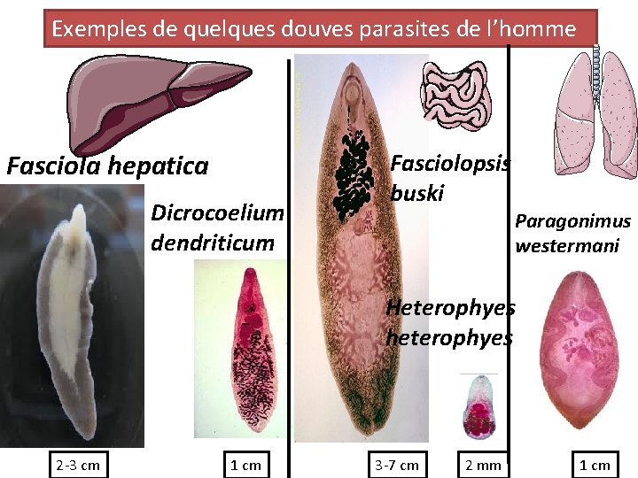 Exemples de quelques douves parasites de l’homme Fasciola hepatica Dicrocoelium dendriticum Fasciolopsis buski Paragonimus