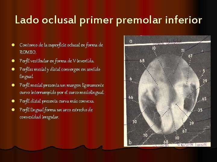 Lado oclusal primer premolar inferior l l l Contorno de la superficie oclusal en