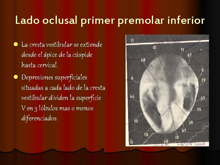 Lado oclusal primer premolar inferior l La cresta vestibular se extiende desde el ápice