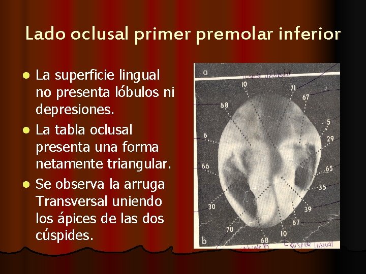 Lado oclusal primer premolar inferior La superficie lingual no presenta lóbulos ni depresiones. l