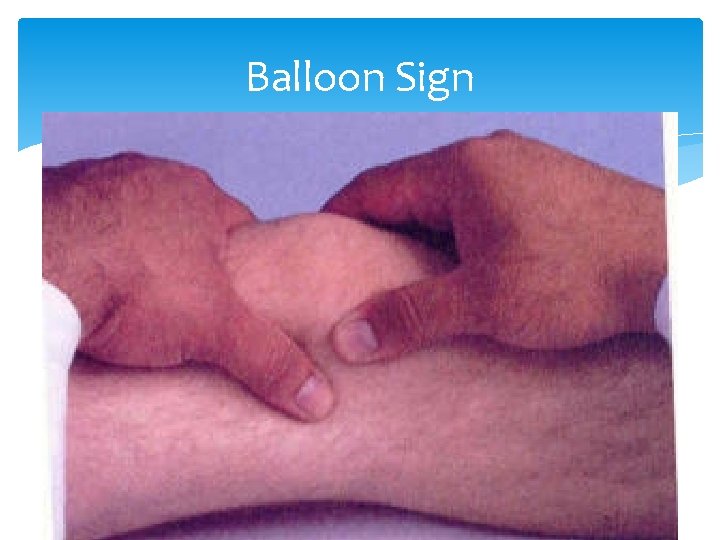 Balloon Sign 