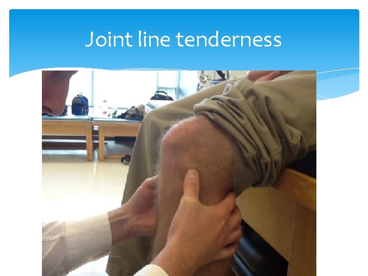 Joint line tenderness 