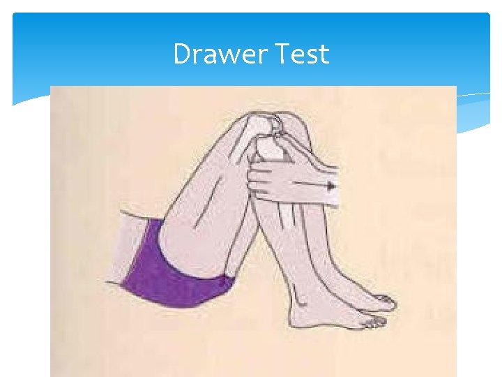Drawer Test 