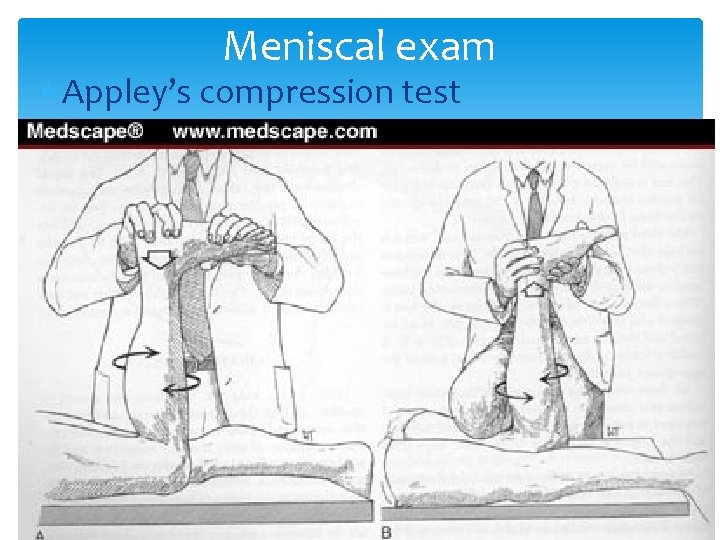 Meniscal exam Appley’s compression test 