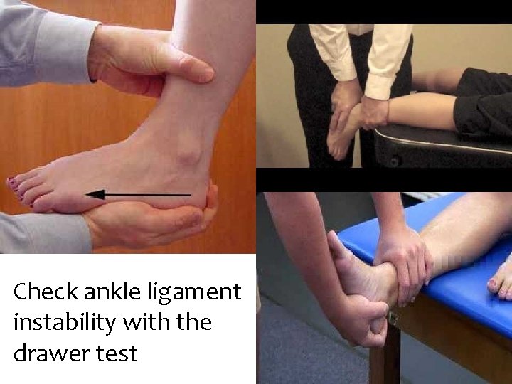 Check ankle ligament instability with the drawer test 