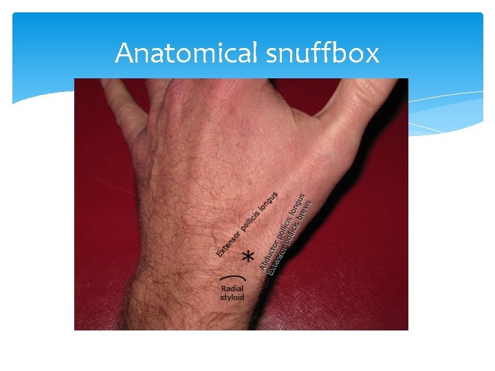 Anatomical snuffbox 