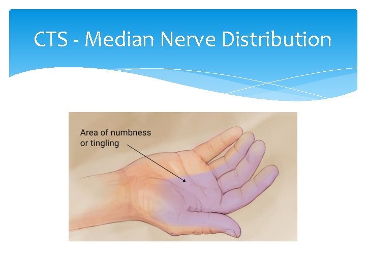 CTS - Median Nerve Distribution 