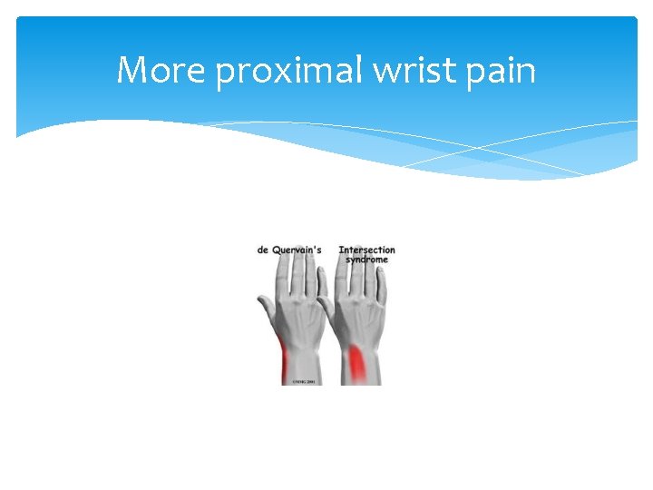 More proximal wrist pain 